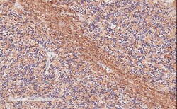 TPPP/p25 Antibody, Novus Biologicals 0.1mg; Unlabeled:Antibodies, Polyclonal